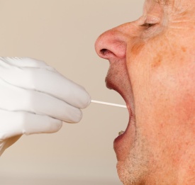 mouth swab