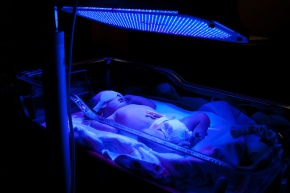 phototherapy_premature_baby