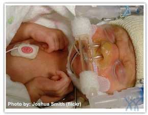 cpap infant